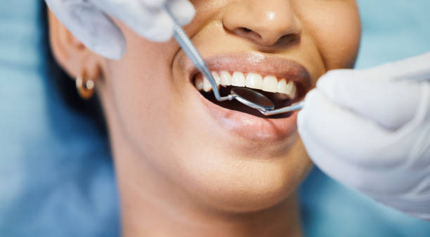 Best Emergency Root Canal Treatment in Cutler, CA