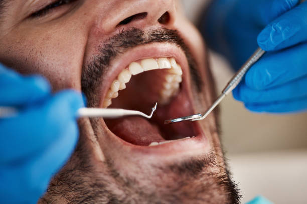 Best Emergency Cosmetic Dentistry in Cutler, CA